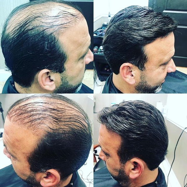 How to choose the new toupee Hair Systems?