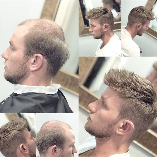 HOW LONG CAN THE MENS TOUPEES LAST
