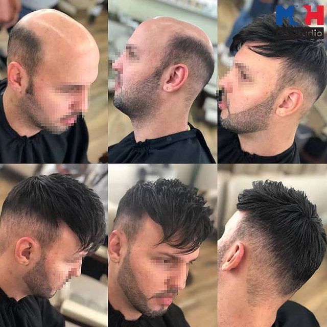 Do you know the base types of toupees?