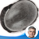 Injected Poly Skin Hair System (0.08-0.10mm) Top View - Yiyohair Men's Hair System